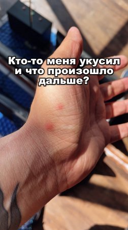 Это надо видеть КАЖДОМУ! Кто-то меня укусил и смотри, что произошло дальше! ДОЛЖЕН ПОСМОТРЕТЬ КАЖДЫЙ