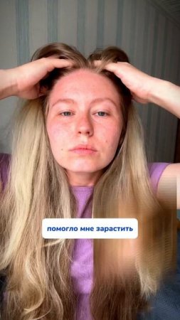 WB: #313747509  OZ: #1833170870 масло эффективное для роста волос 👱♀️