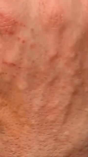 Огненные муравьи. Самые опасные насекомые #shorts смотреть онлайн