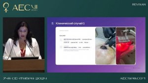 Сетко Ирина. Осложнения после маммопластики (Revixan / Сферогель)