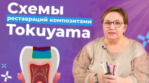 Как наносить композиты Tokuyama?