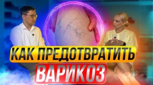 Как предотвратить варикоз ?