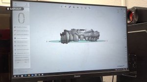 Какой материал для вставных зубов сейчас cчитается самым надежным