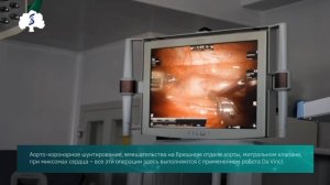 Операция на сердце через 3 прокола 🦾 Доверяете роботу?