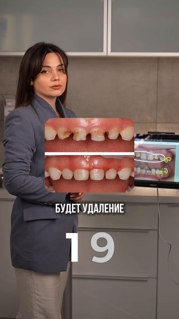 План лечения за 30 секунд для детей