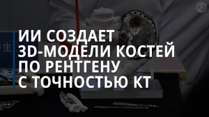 ИИ создает 3D-модели костей по рентгену с точностью КТ