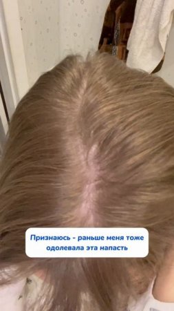 Достала перхоть?
WB #313747509 Ozon #1833170870 #маслорозмарина #отперхоти #перхоть #уходзаволосами