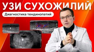 УЗИ сухожилий: как диагностировать тендинопатию?