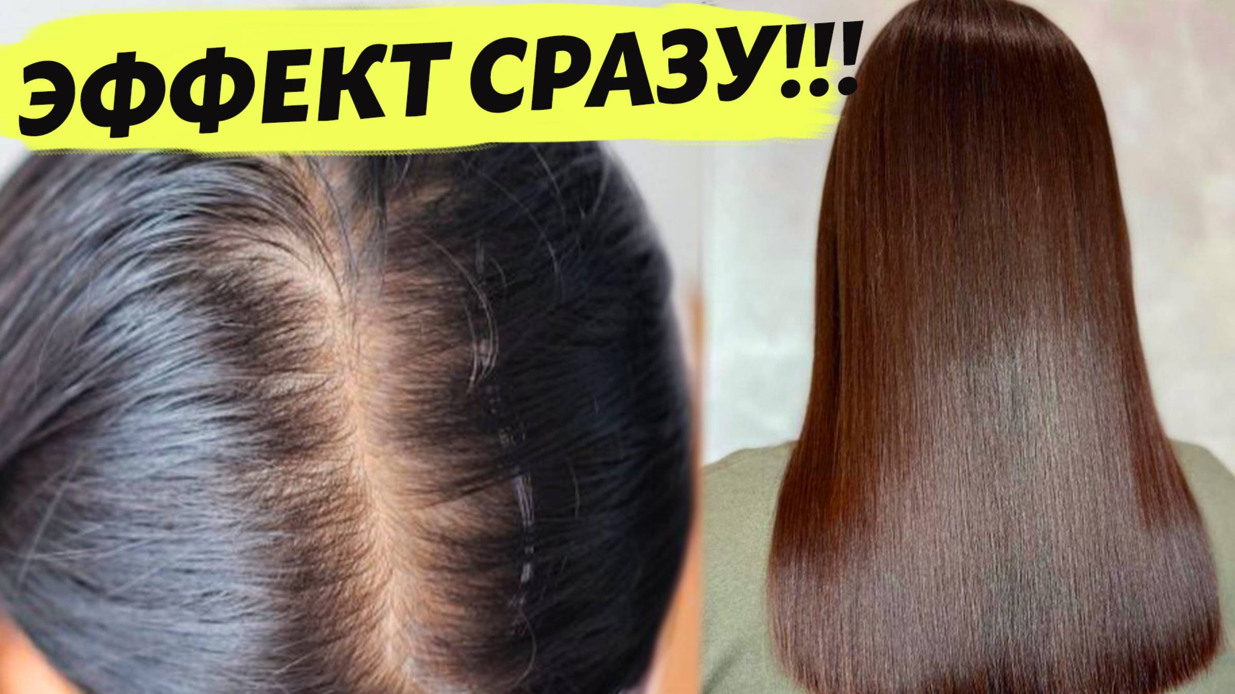 ТОЛЬКО ЭТО СПАСЛО ОТ ОБЛЫСЕНИЯ! Нанесла на корни и волосы растут как сумасшедшие и не выпадают! смотреть онлайн