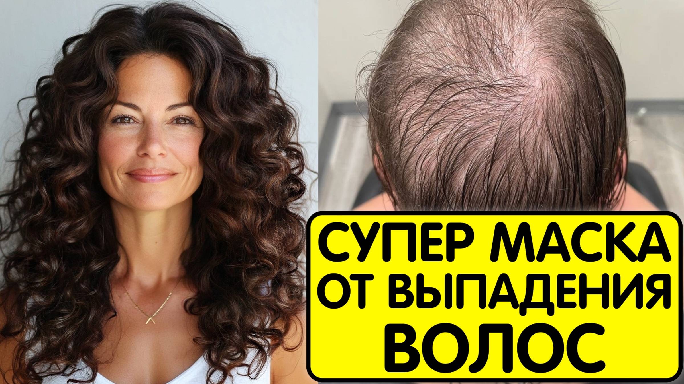 Эта МАСКА СПАСЛА ОТ ВЫПАДЕНИЯ ВОЛОС ! Волосы растут как сумасшедшие и СТАЛИ ГУЩЕ смотреть онлайн