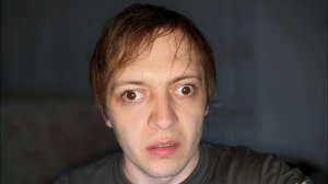 СТОИТ ЛИ ДЕЛАТЬ ОПЕРАЦИЮ ПО ИСПРАВЛЕНИЮ КОСОГЛАЗИЯ? ПОМОЖЕТ ЛИ ОНА НАЙТИ ДЕВУШКУ