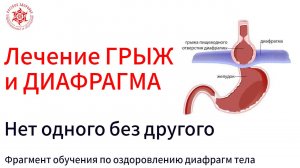 Грыжа пищеводного отверстия и роль диафрагмы. Фрагмент обучения по оздоровлению диафрагм тела