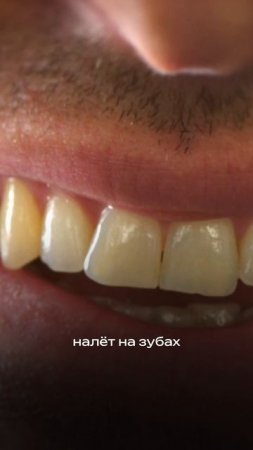 Что стало с зубами после голодания ?! #голод #голодание #здоровье #зож