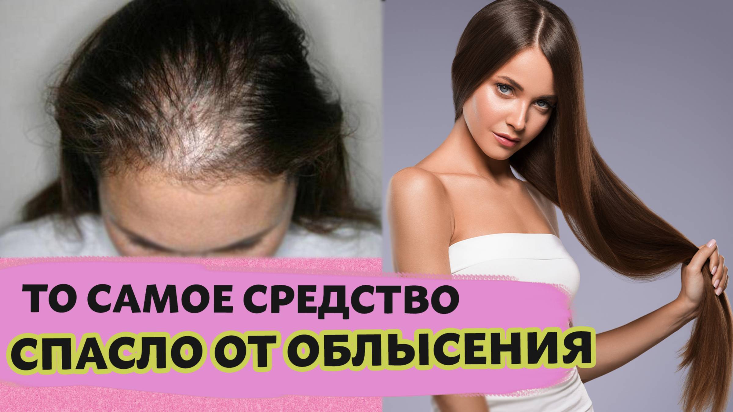 МОИ ВОЛОСЫ РАСТУТ на дрожжах и СТАЛИ В 3 РАЗА ГУЩЕ! Восстановит самые ломкие волосы. смотреть онлайн