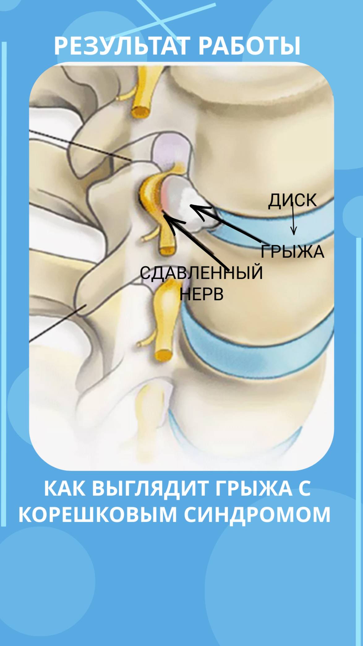 Боль в ноге и пояснице: как изменилось состояние после работы? смотреть онлайн