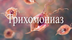 Трихомонада