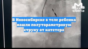 В Новосибирске в теле ребенка нашли полутораметровую струну от катетера