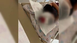 Мать сбитого самокатом 4-летнего мальчика в Краснодаре рассказала о ДТП