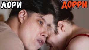 Что стало с девушками, которые срослись между собой?!