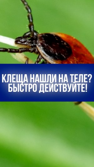 Не стойте на месте: первые 24 часа после укуса клеща решают вашу судьбу — что делать?