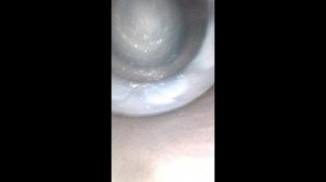 Видео эндоскопии K9K