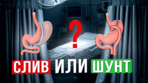 Продольная резекция желудка или шунтирование?