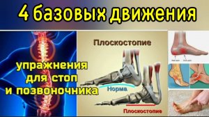 Низкий продольный свод стопы губит позвоночник, тазобедренные суставы? Уникальное 4-фазное движение