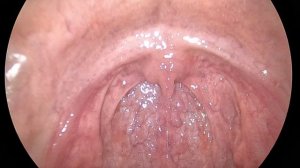 Демонстрационное видео 4K эндоскопической камеры