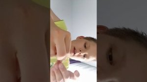 Дал себя ужалить опасному насекомому!!!
