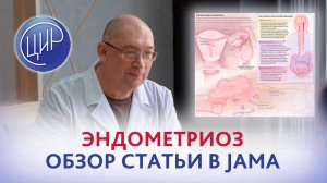 Эндометриоз: обзор статьи в JAMA - в журнале Американской Медицинской Ассоциации.