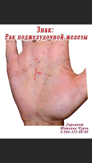 Знак. Хиромантия. Здоровье.
обучение fyp хиромантия