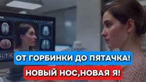 От горбинки до пятачка: новый нос и новая я! Реальный кейс ринопластики