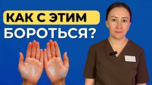 ПРИЧИНЫ повышенного потоотделения