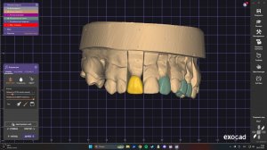 Формы зуба и их грани