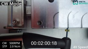 EQ-M Эндомотор Мета | Обзор