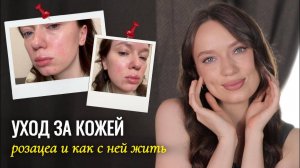 Уход за кожей лица | Уход за чувствительной кожей с розацеа
