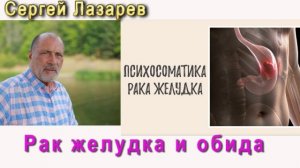 Сергей Николаевич Лазарев Рак желудка