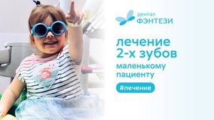 Лечение 2 зубов маленькому пациенту. Процесс лечения кариеса