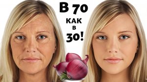 ЛУК Сильнее Ботокса! Удаляет морщины и Пятна на лице! Даже в 70 лет! Эта МАСКА "ИСТОЧНИК МОЛОДОСТИ"