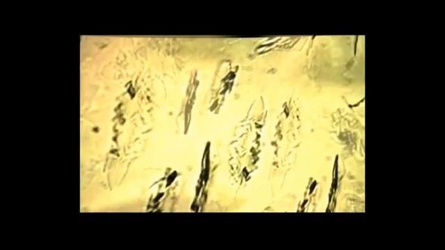 Металлоплакирующие комплексы "Valena-SV". Техническая помощь. Выпуск 12