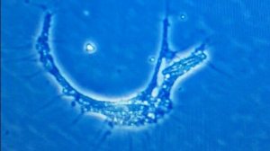 ДИЗЕНТЕРИЙНАЯ АМЕБА: КАК ОНА ВЫЕДАЕТ ТВОИ КИШКИ ЗАЖИВО?