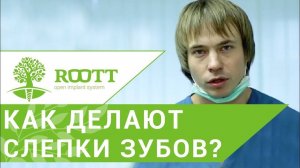 Слепок зубов. Современные материалы для изготовления слепка зубов. ROOTT