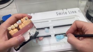 Изготовление мостовидной конструкции из 3х единиц