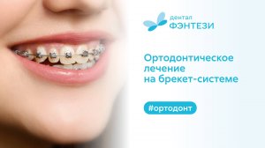 Ортодонтическое лечение на брекет-системе в Дентал Фэнтези