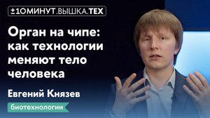 +/-10 минут. Вышка.Тех / Орган на чипе: как технологии меняют тело человека