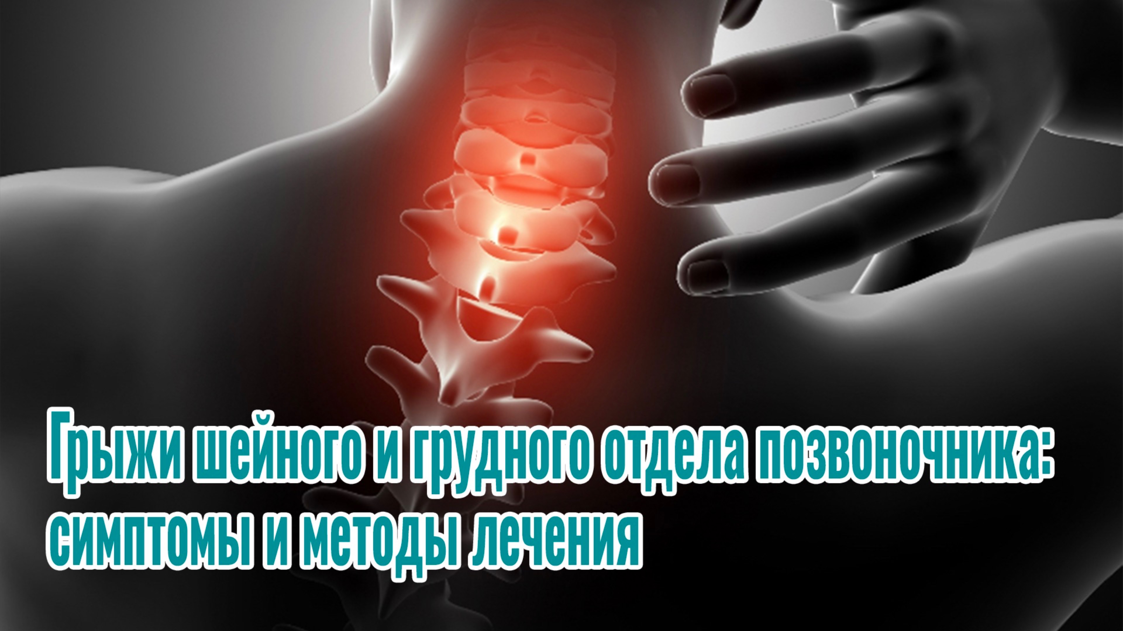 Грыжи шейного и грудного отдела позвоночника: симптомы и методы лечения