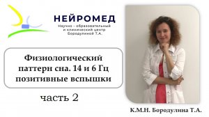 Физиологический паттерн сна 14 и 6 Гц позитивные вспышки (часть 2)