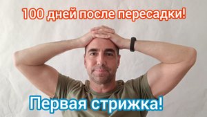 Сто дней после пересадки. Первая стрижка! Пересадка волос в Санкт-Петербурге.