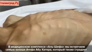 Дети на грани смерти от голода — в секторе Газа острая нехватка еды.