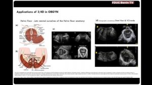 3Д и 4Д сканирование плода, техника сканирования